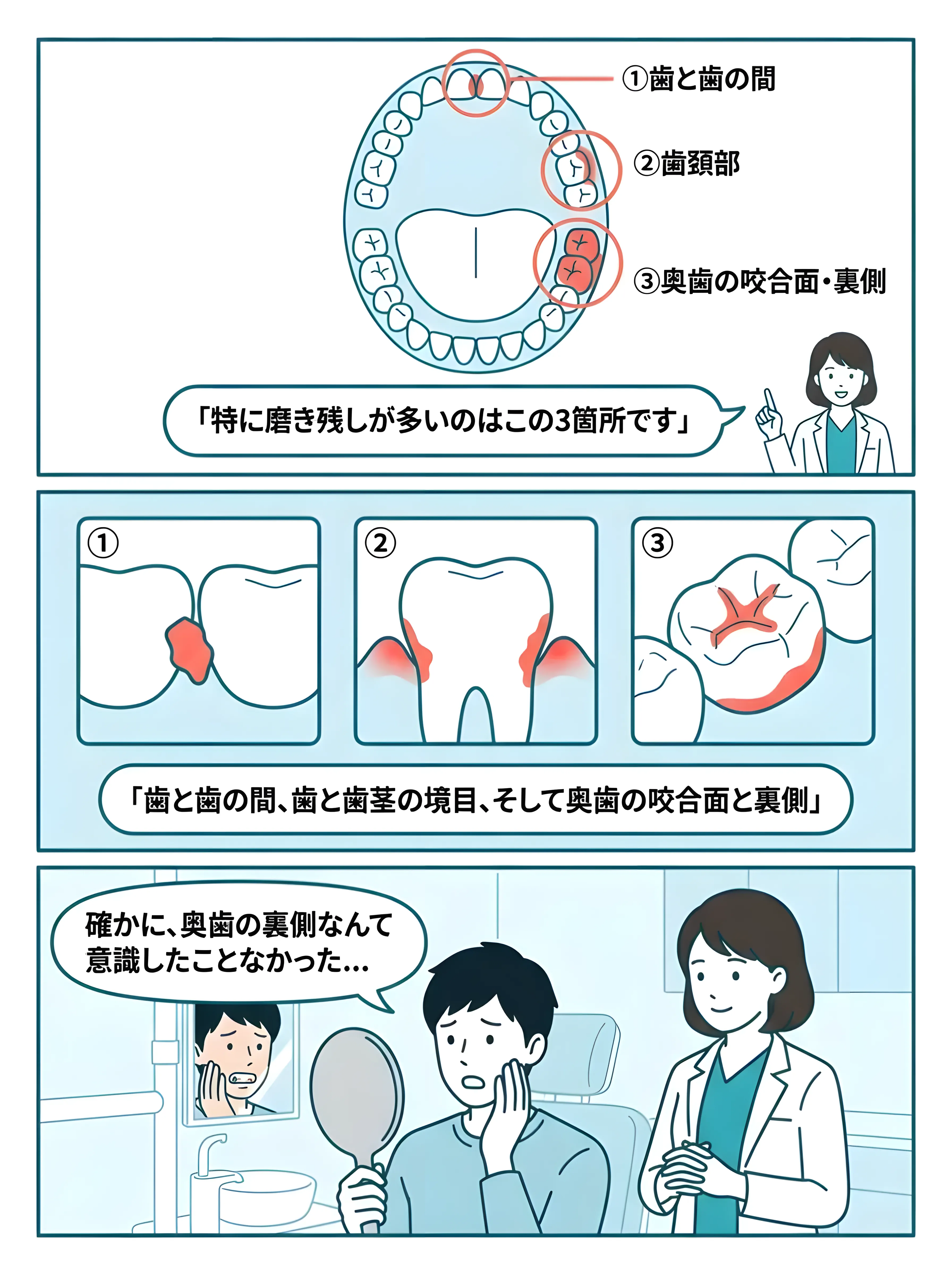 磨き残しやすい場所の解説マンガ - 歯と歯の間・歯頚部・奥歯の図解