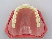 総入れ歯レジン床義歯