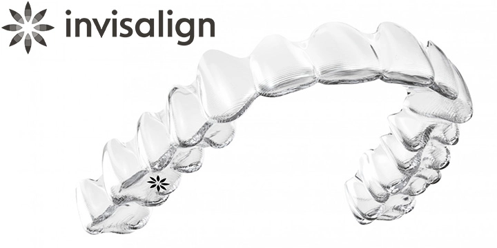 マウスピース製作